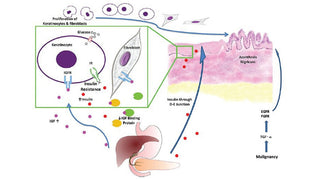 Acanthosis Nigricans | What Causes Dark Armpit Skin | Natural Deodorant Myth | Awake Organics | UK Beauty Brand Brand | diagram image