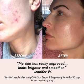 Clear Skin Balancing Treatment Oil